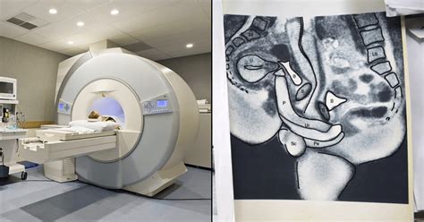 what does a creampie look like|An inside view of sex: MRI scanner captures intercourse as you。